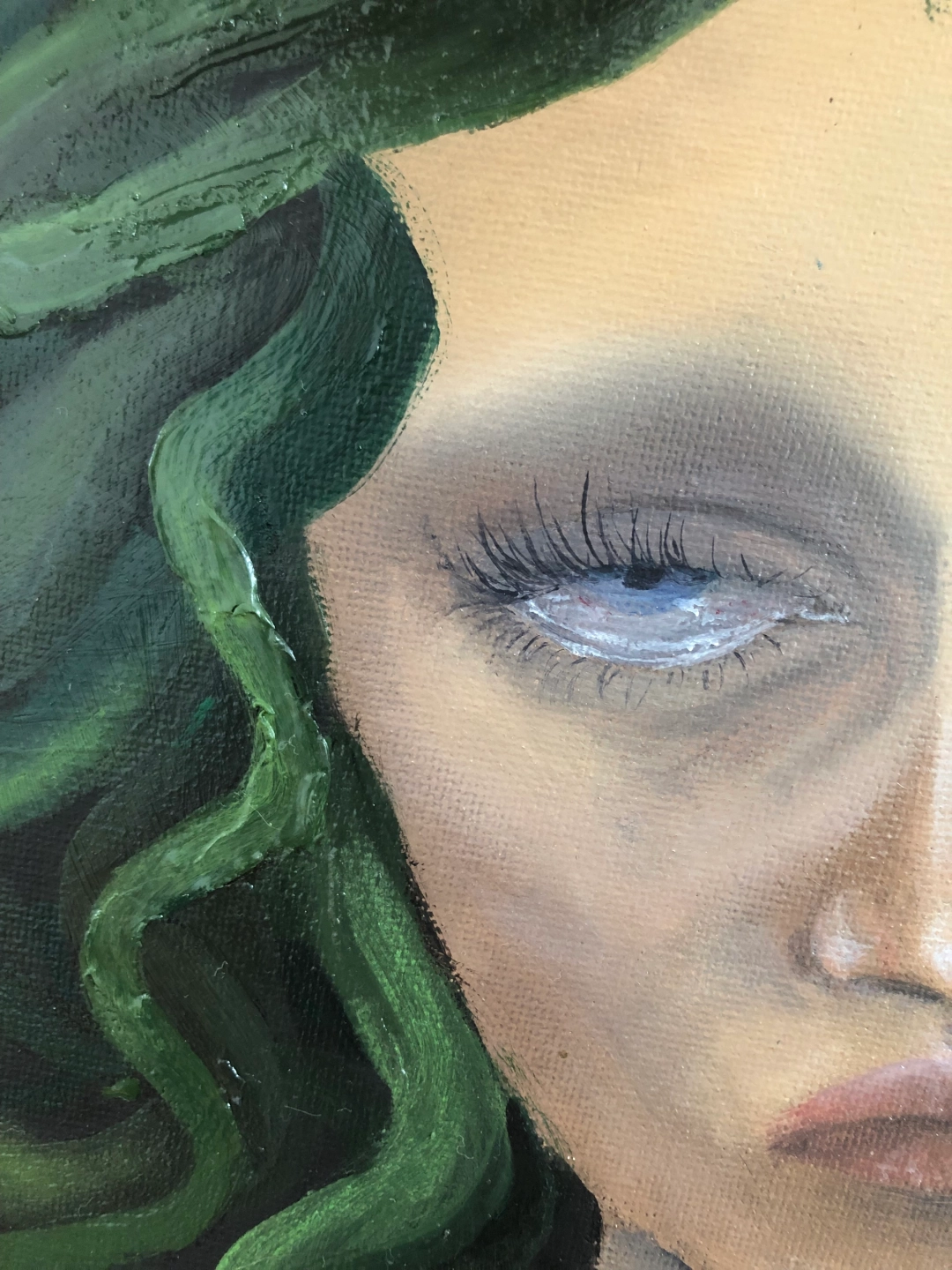 Medusa
